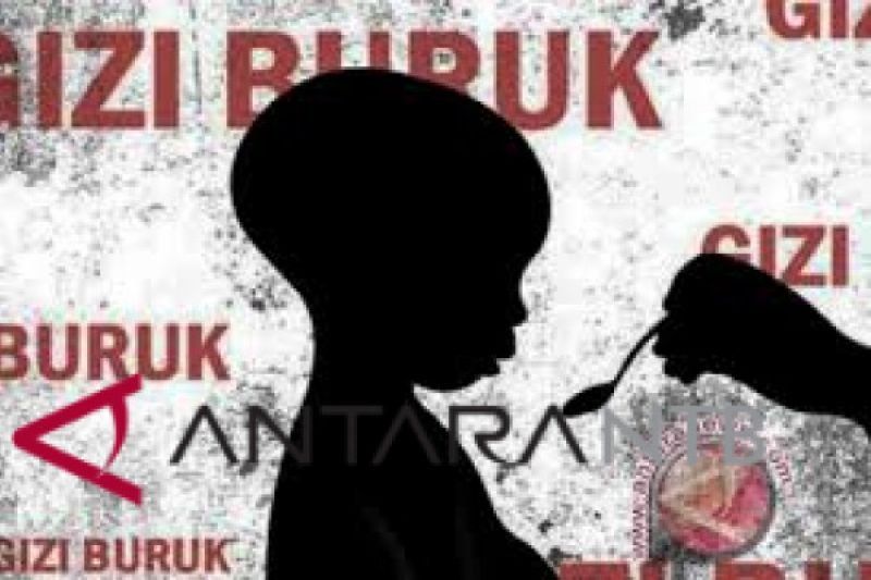 Astaga! 1 dari 12 Anak Alami Gizi Buruk di Simeulue Aceh Meninggal Dunia