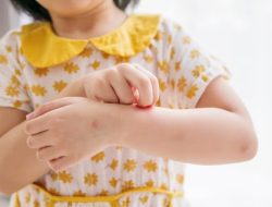 6 Tips Mengatasi Biang Keringat pada Bayi dan Anak