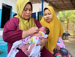 Bayi Perempuan di Sampang Madura Lahir dengan 24 Jari